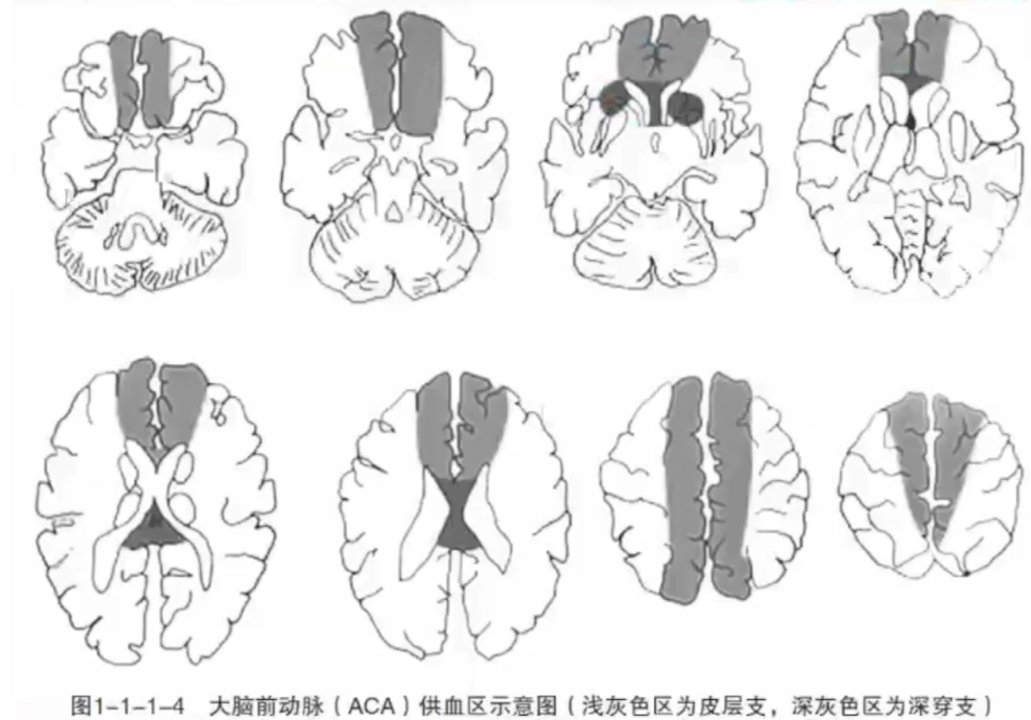 影像PPT - 急性脑梗死临床及其MRI影像特点-5 影像PPT - 急性脑梗死临床及其MRI影像特点-5