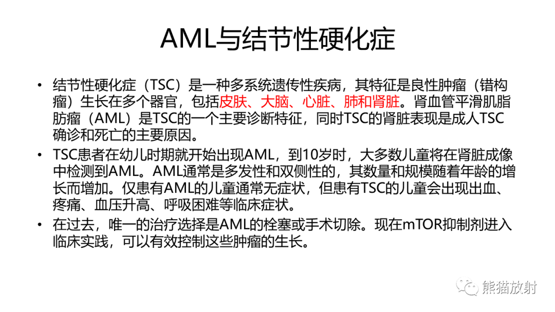 影像PPT - 【病例】肾血管平滑肌脂肪瘤AML二例影像-19