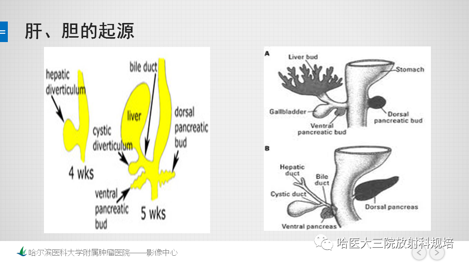 影像PPT - 【PPT】肝内胆管错构瘤的影像诊断-5
