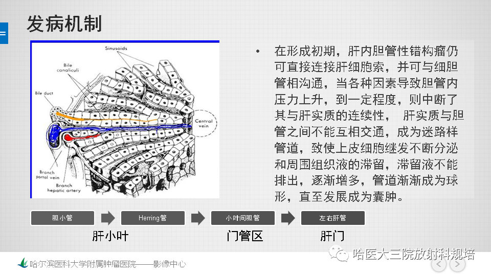 影像PPT - 【PPT】肝内胆管错构瘤的影像诊断-6