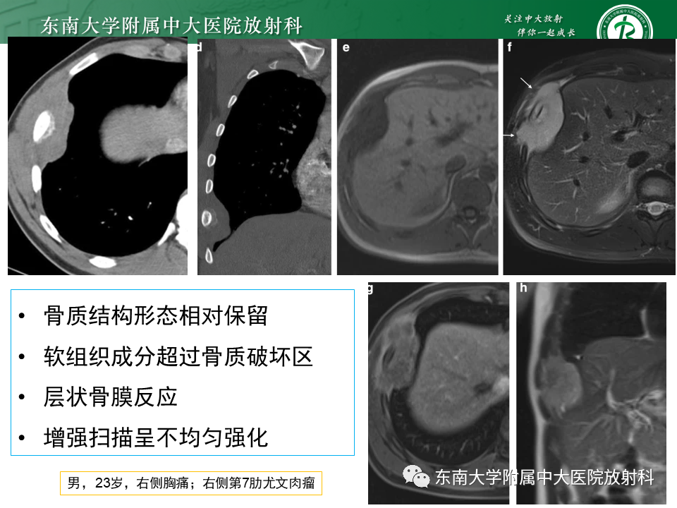 影像PPT - 【病例】肋骨孤立性溶骨性病变病例讨论-22
