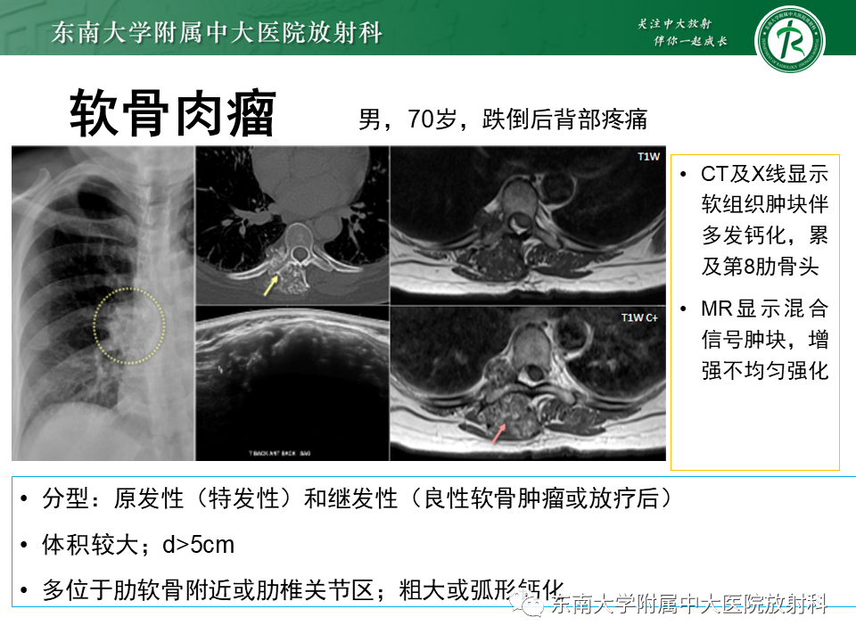 影像PPT - 【病例】肋骨孤立性溶骨性病变病例讨论-29