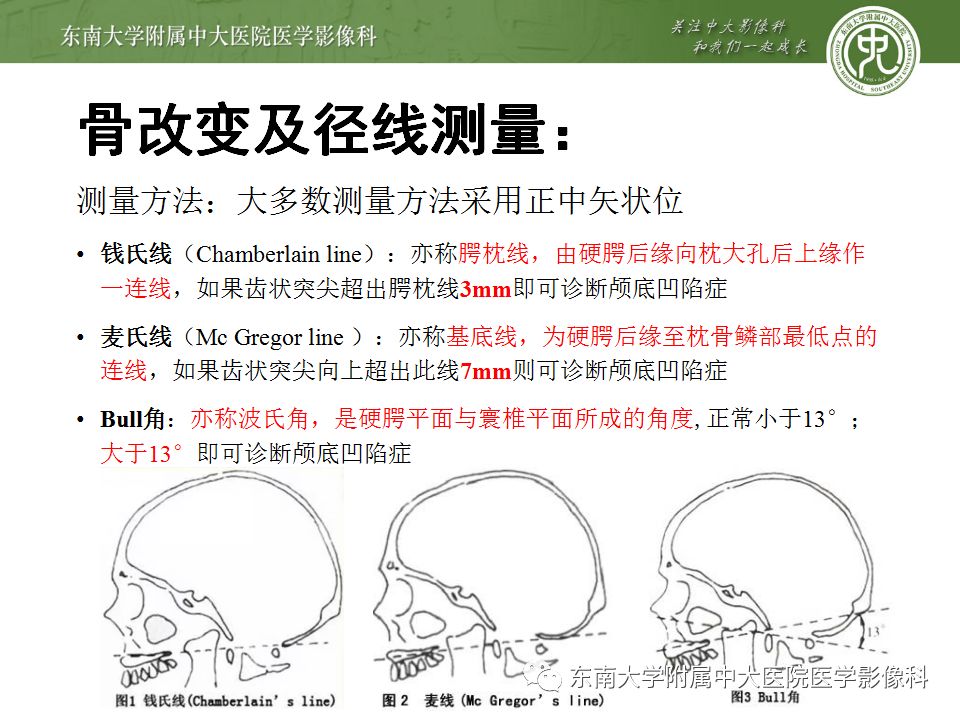 影像PPT - 【PPT】颅底凹陷症-11