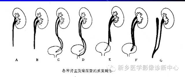 影像PPT - 发生在肾脏的“无面征”-2
