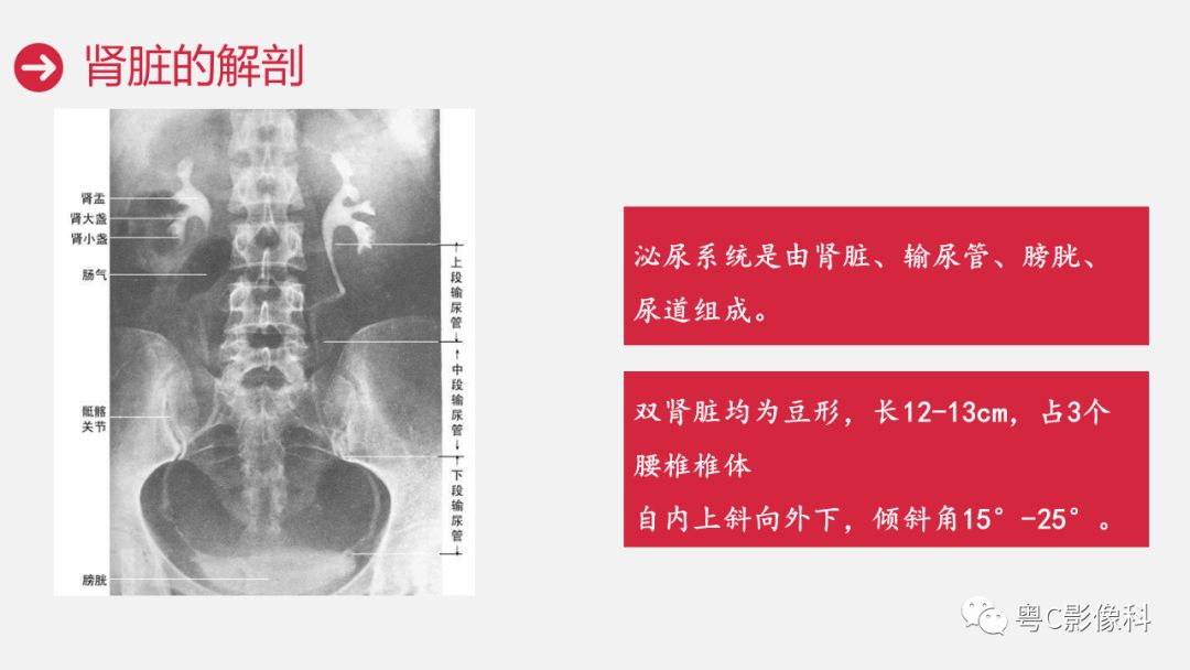 影像PPT - 【PPT】泌尿系CTU扫描技术-7