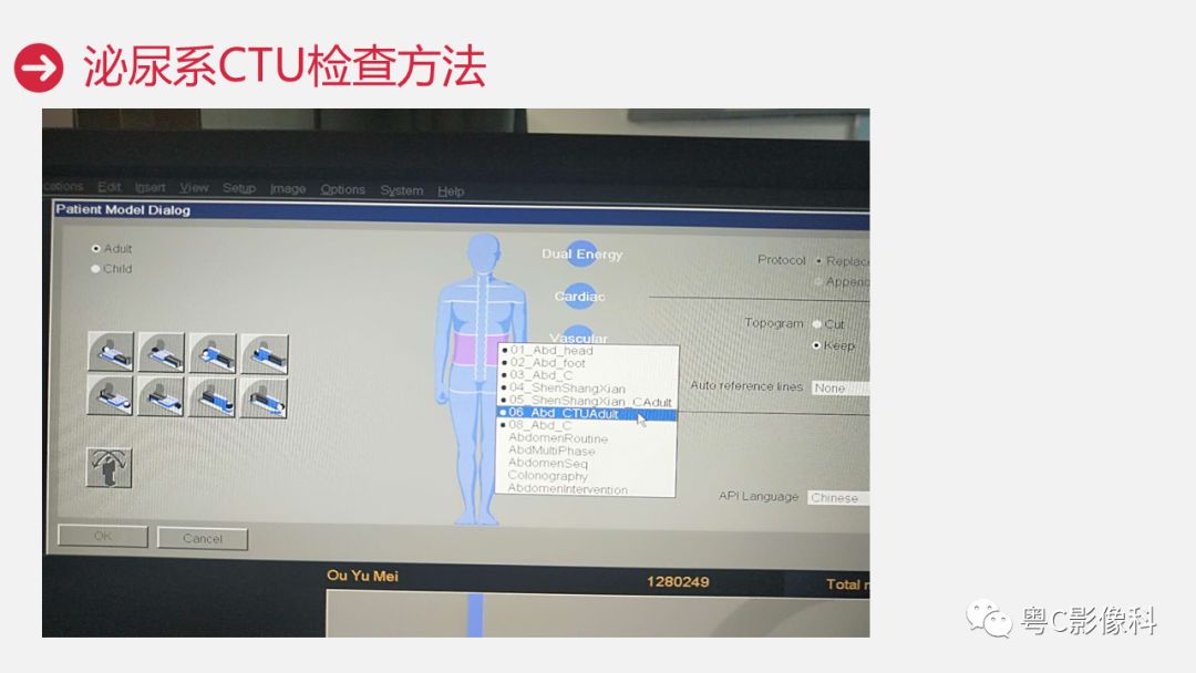 影像PPT - 【PPT】泌尿系CTU扫描技术-19