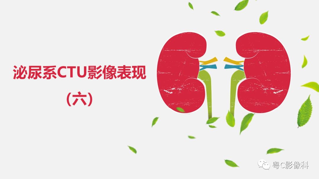 影像PPT - 【PPT】泌尿系CTU扫描技术-22