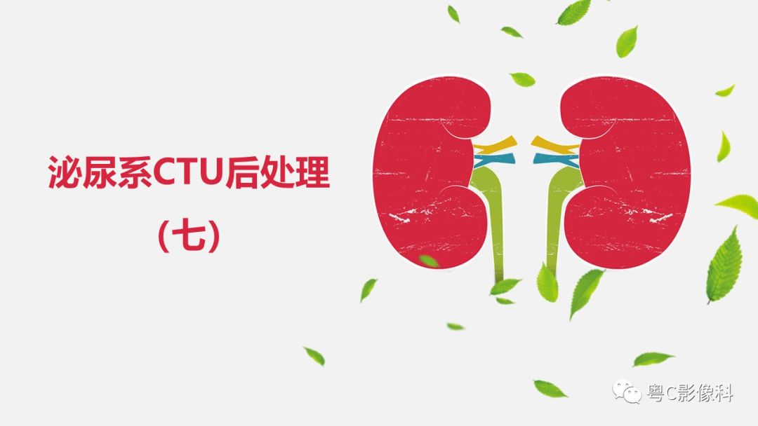 影像PPT - 【PPT】泌尿系CTU扫描技术-26