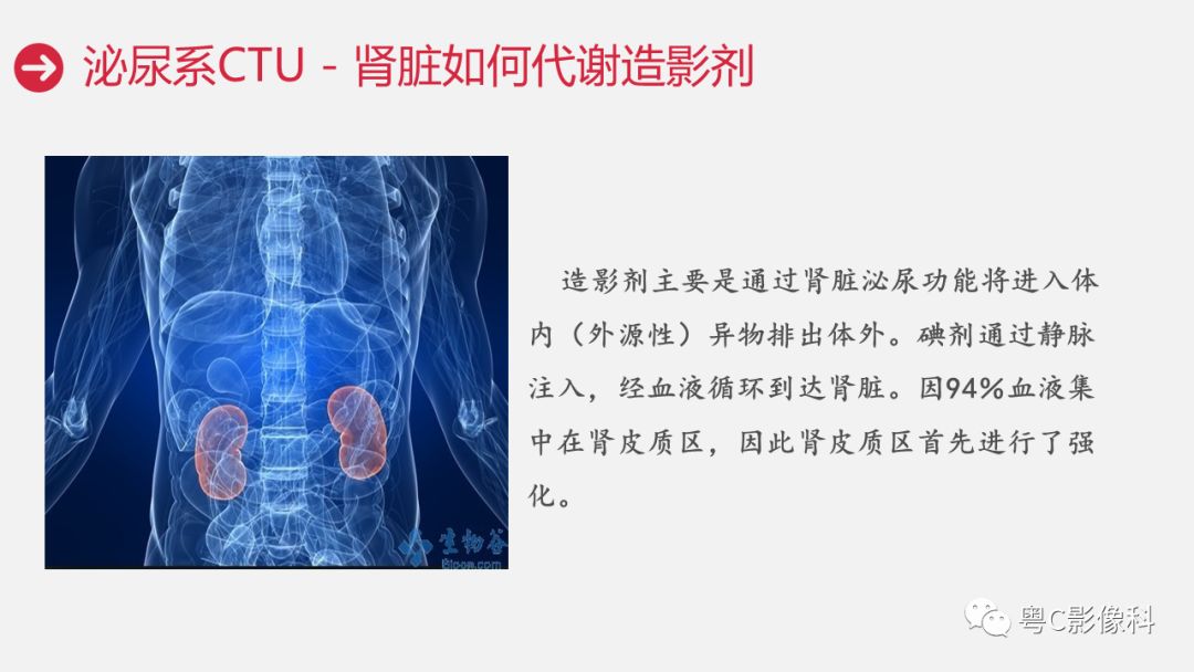影像PPT - 【PPT】泌尿系CTU扫描技术-35