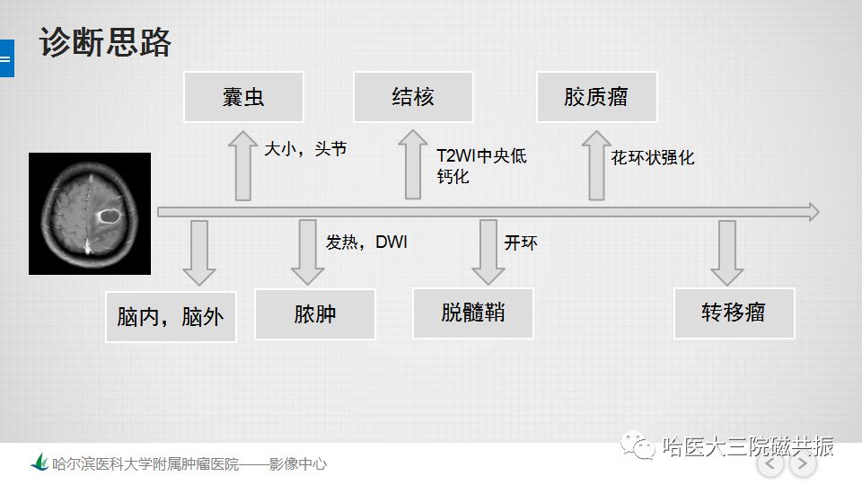 影像PPT - 【PPT】脑内环形强化 除了转移瘤你能想到什么-73