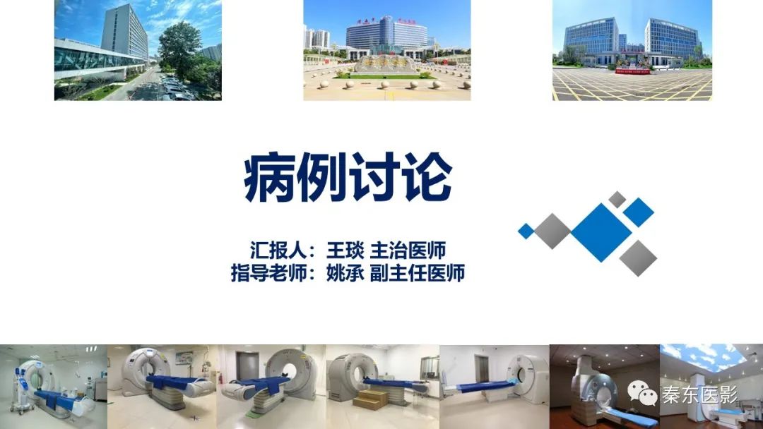 影像PPT - 【病例】胃肠道间质瘤-1