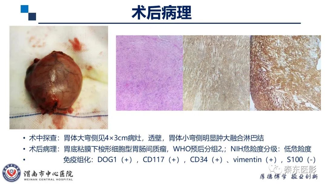 影像PPT - 【病例】胃肠道间质瘤-8