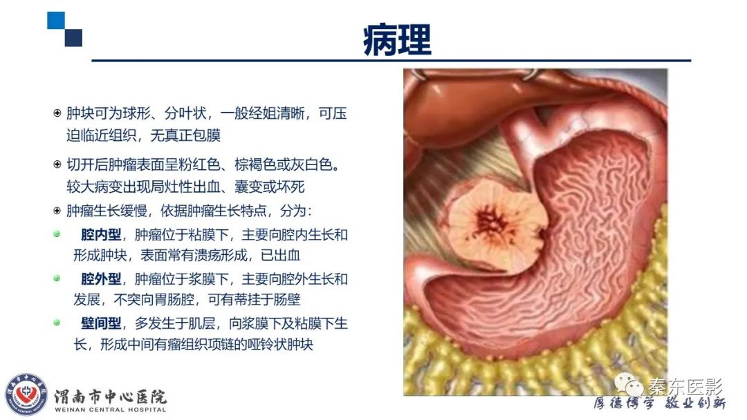 影像PPT - 【病例】胃肠道间质瘤-12