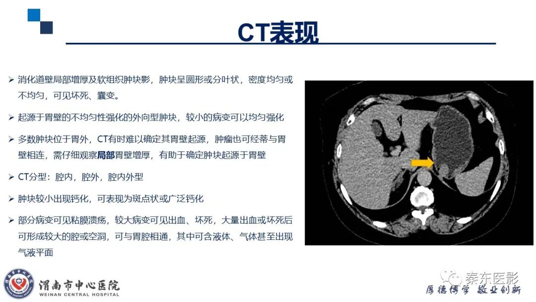 影像PPT - 【病例】胃肠道间质瘤-14