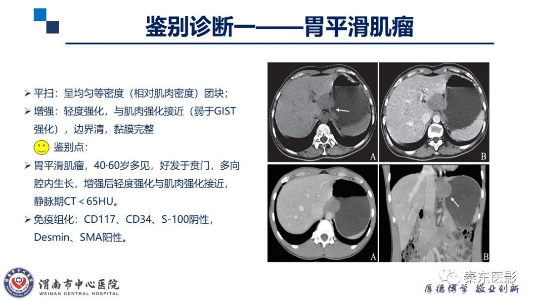 影像PPT - 【病例】胃肠道间质瘤-18