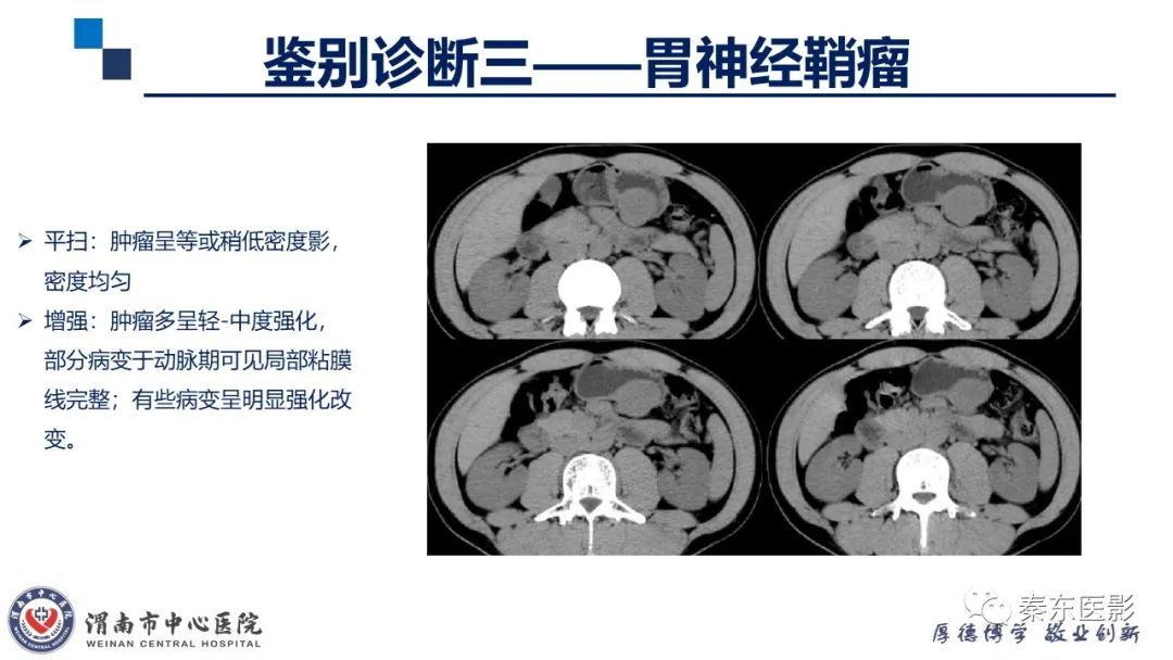 影像PPT - 【病例】胃肠道间质瘤-21