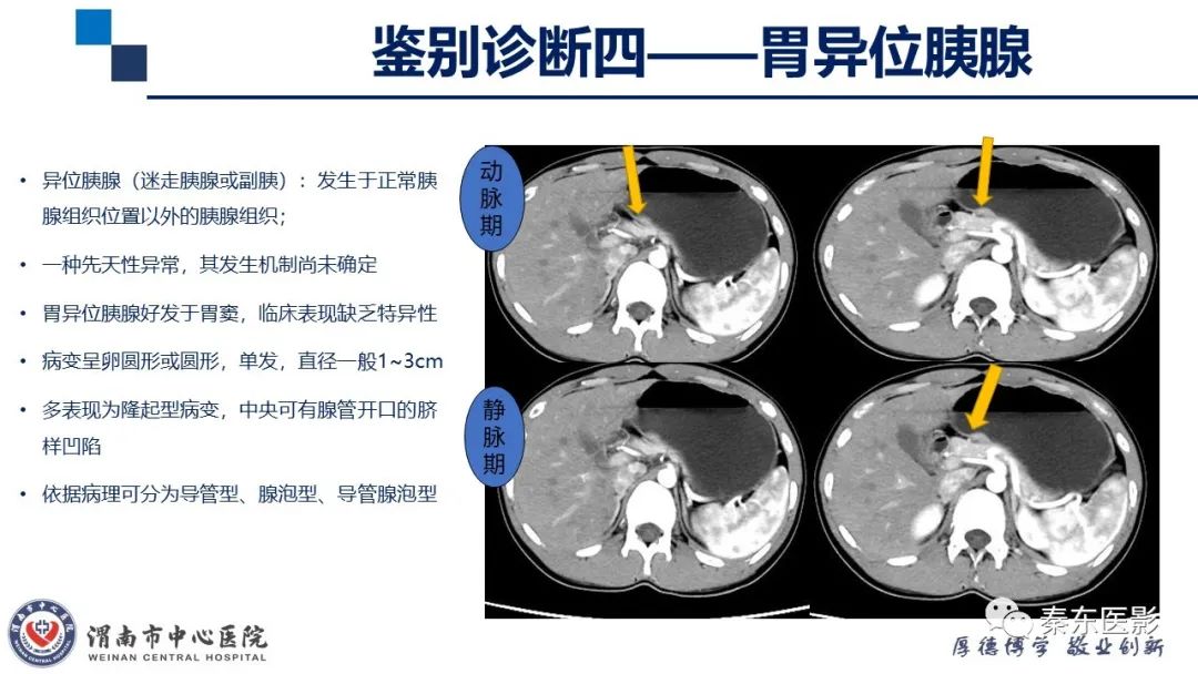 影像PPT - 【病例】胃肠道间质瘤-23
