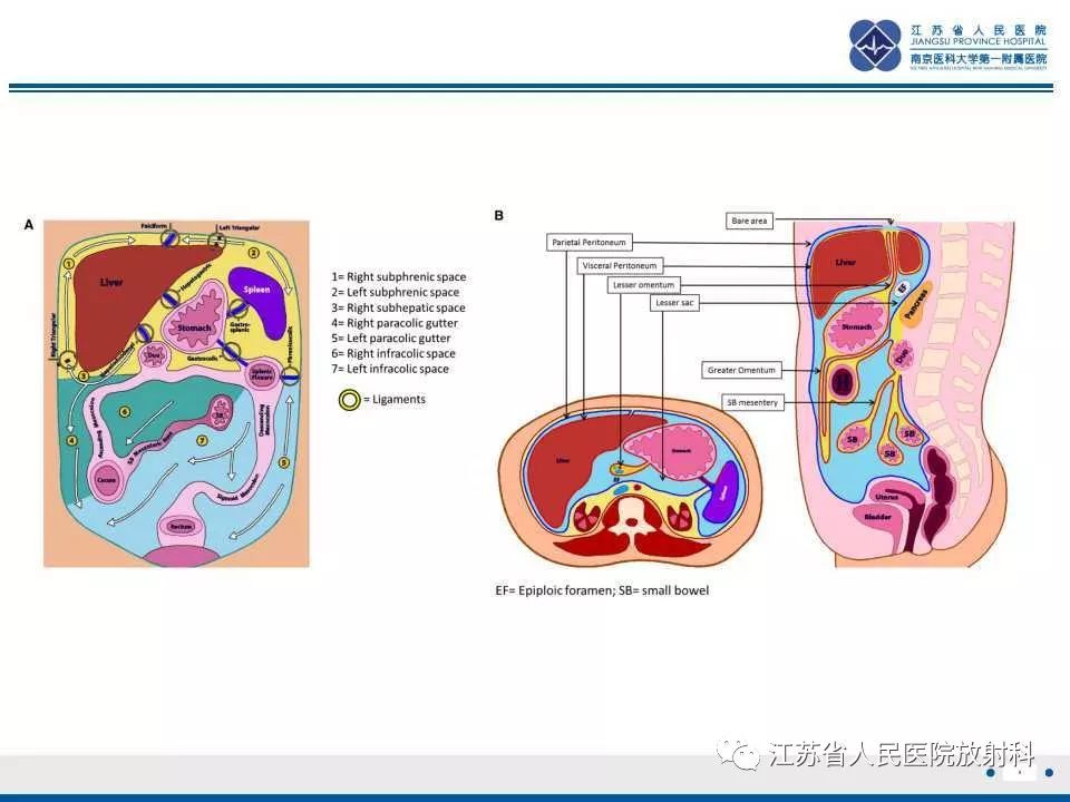 影像PPT - 【PPT】网膜梗死-9