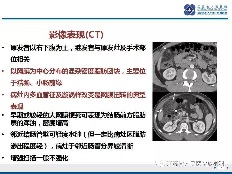 影像PPT - 【PPT】网膜梗死-19