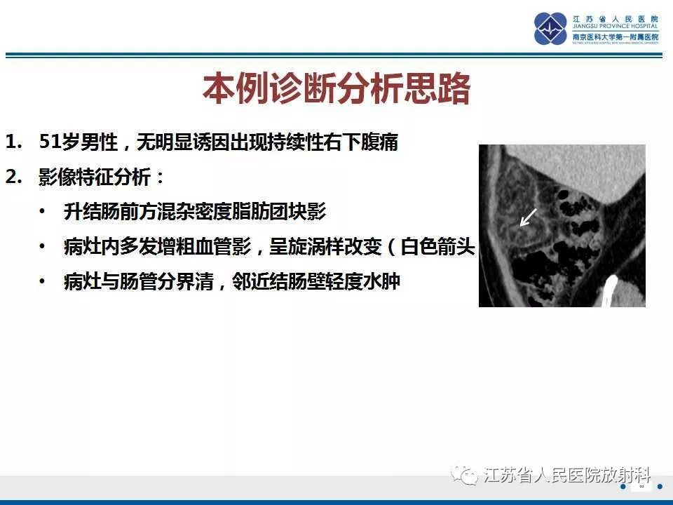 影像PPT - 【PPT】网膜梗死-22
