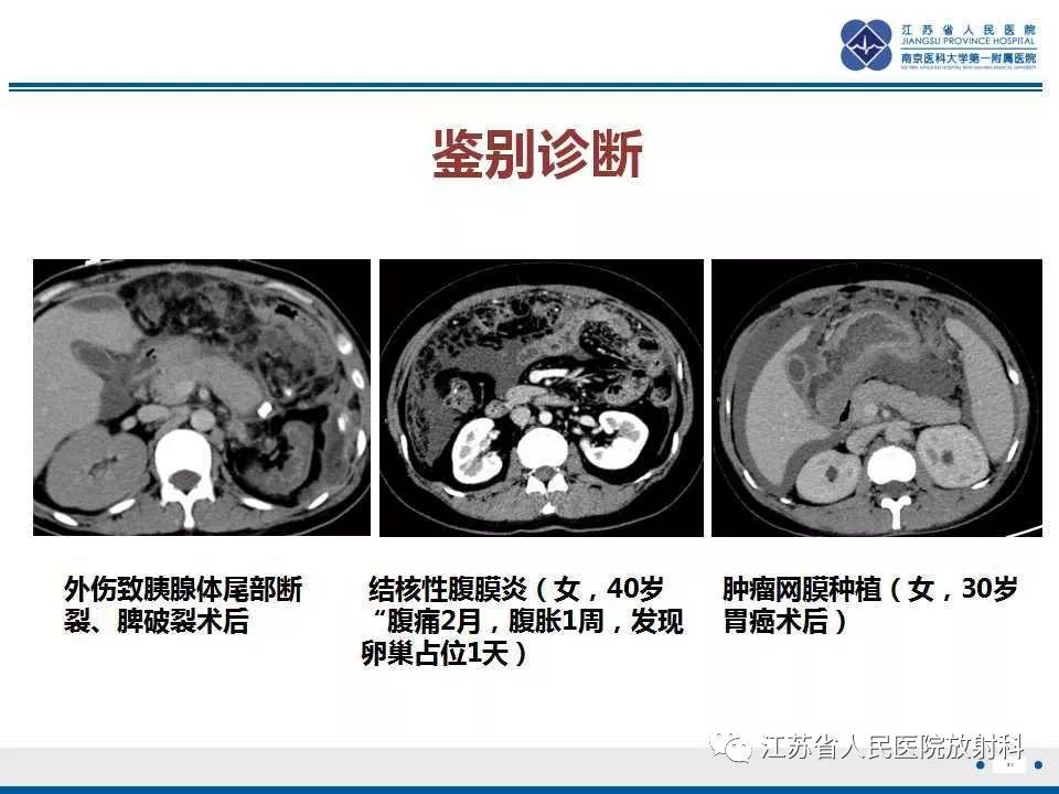 影像PPT - 【PPT】网膜梗死-31