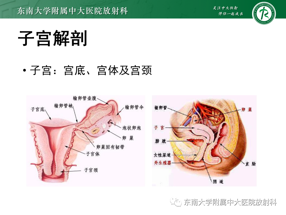 影像PPT - 【PPT】子宫内膜癌MRI诊断-10 影像PPT - 【PPT】子宫内膜癌MRI诊断-10