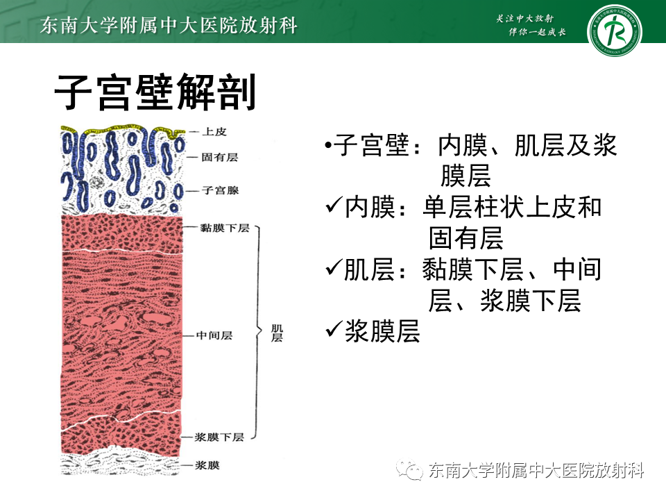 影像PPT - 【PPT】子宫内膜癌MRI诊断-11 影像PPT - 【PPT】子宫内膜癌MRI诊断-11