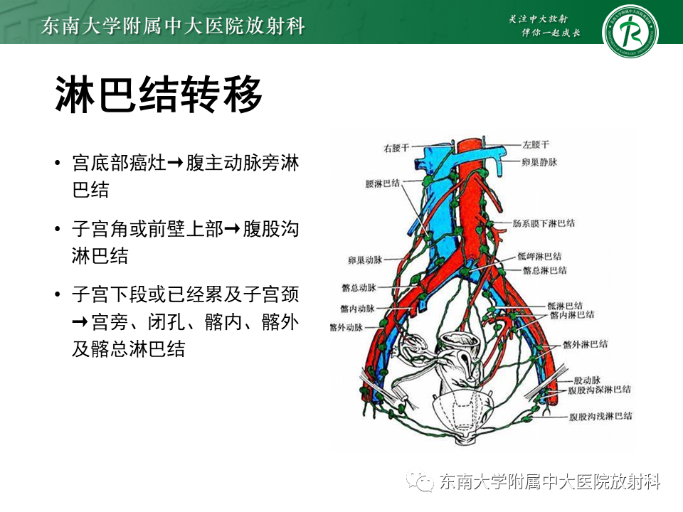 影像PPT - 【PPT】子宫内膜癌MRI诊断-15 影像PPT - 【PPT】子宫内膜癌MRI诊断-15