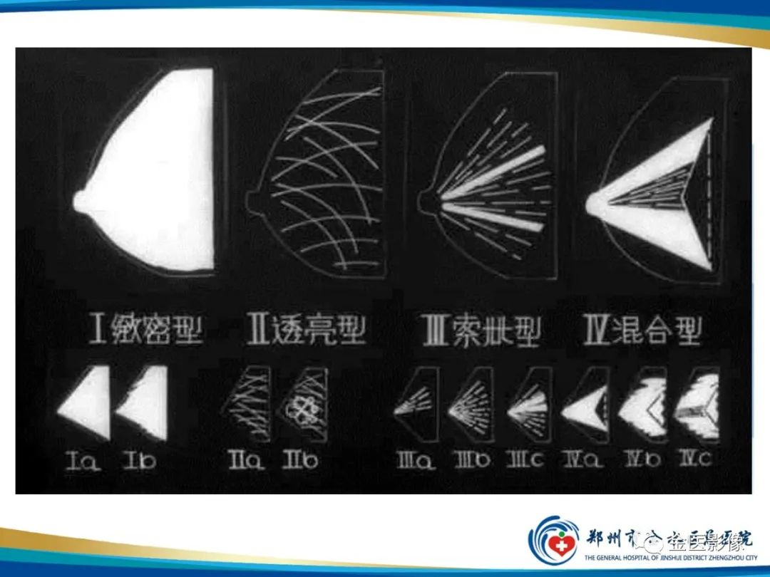 影像PPT - 【PPT】乳腺数字化钼靶X线诊断及临床应用-14
