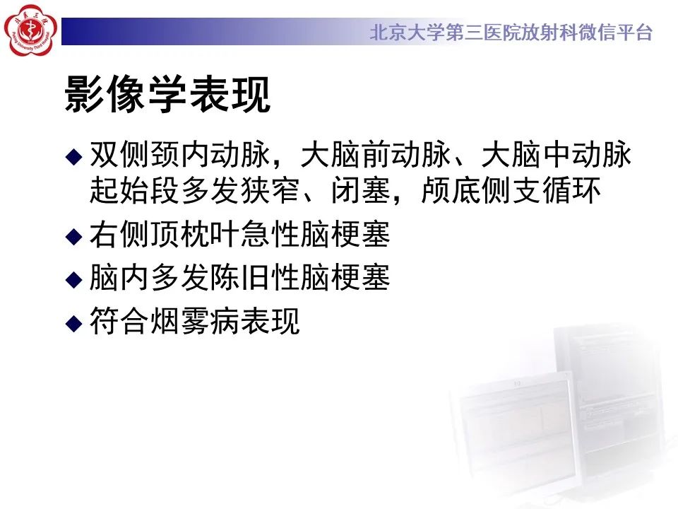 影像PPT - 【PPT】烟雾病-5