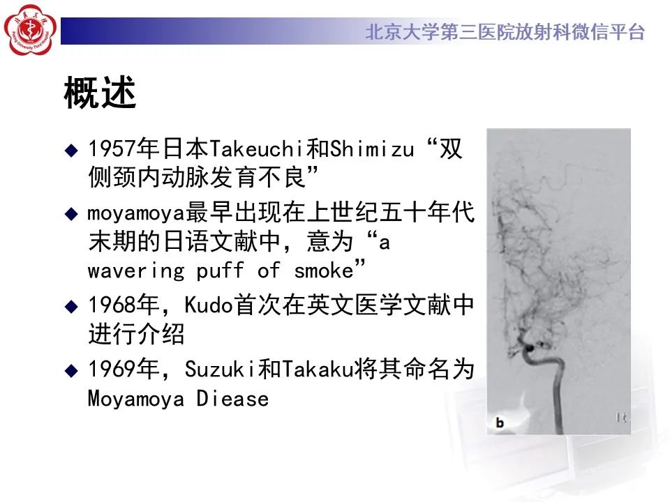 影像PPT - 【PPT】烟雾病-8