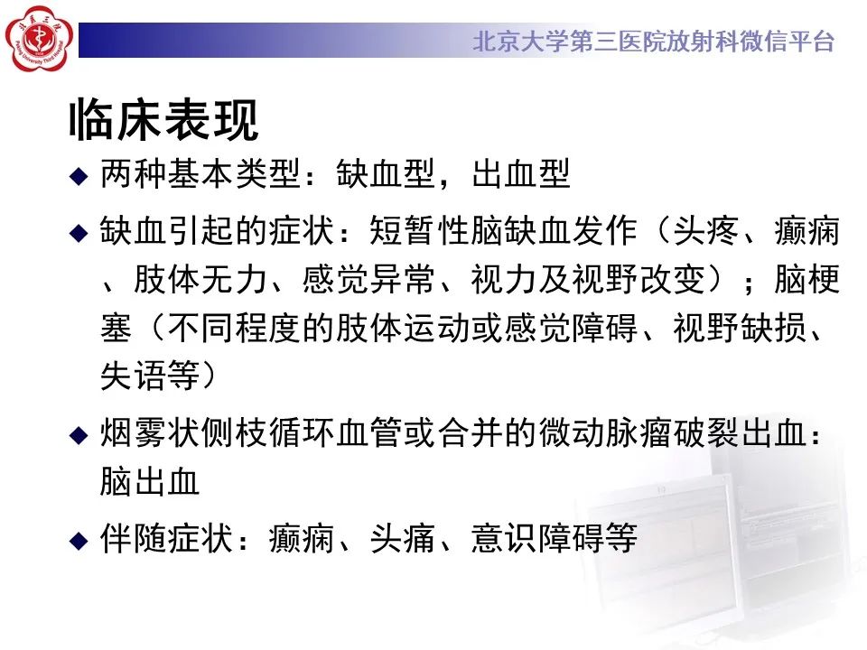 影像PPT - 【PPT】烟雾病-10