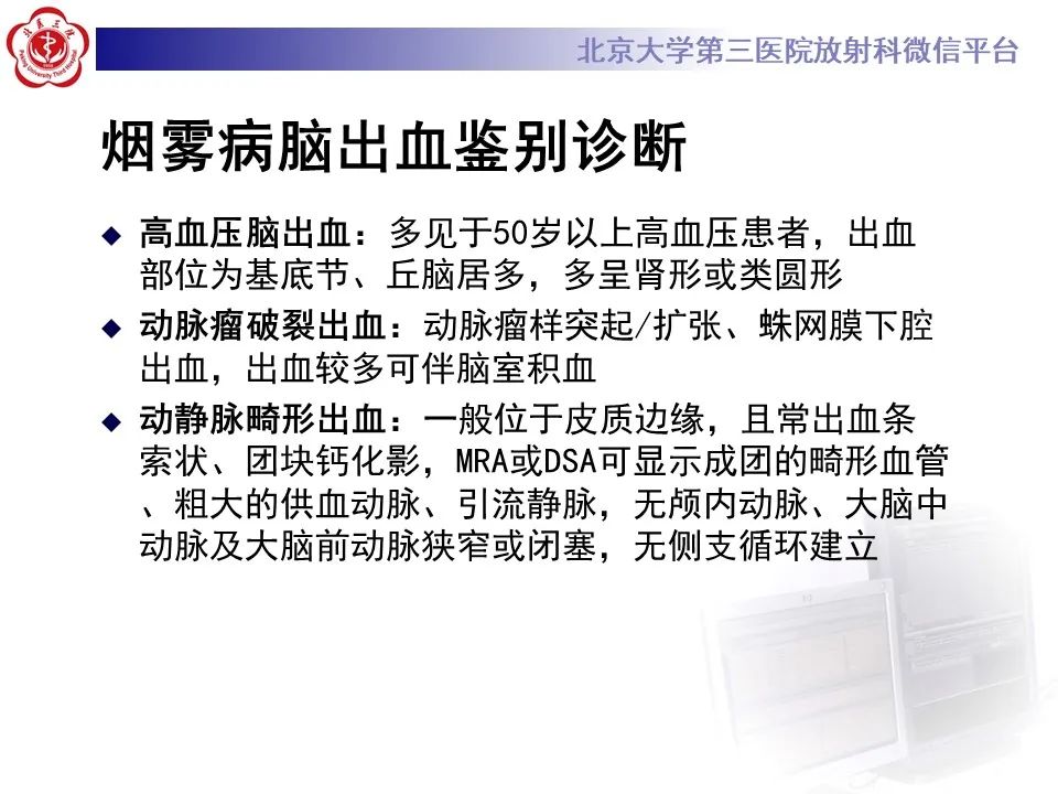 影像PPT - 【PPT】烟雾病-21