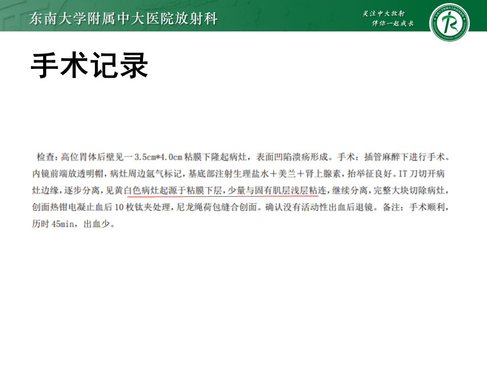 影像PPT - 【PPT】胃间质瘤（GST）-8