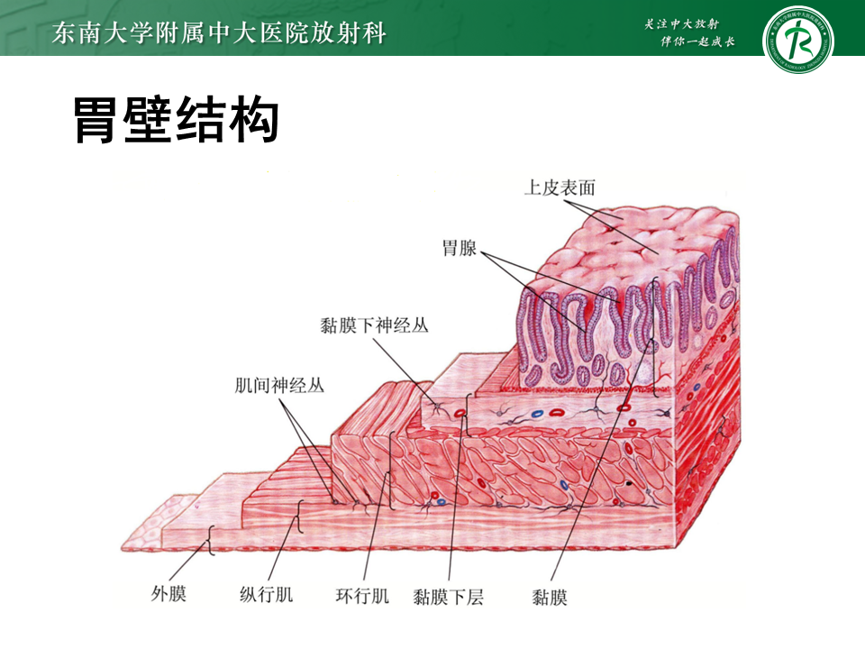 影像PPT - 【PPT】胃间质瘤（GST）-13