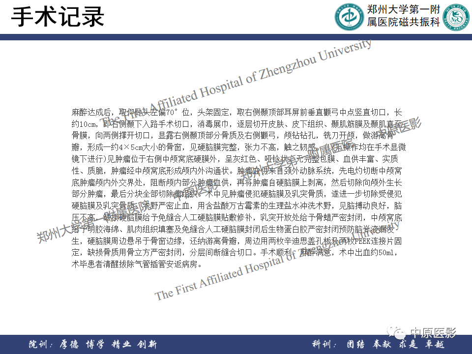 影像PPT - 【病例】颞部腱鞘巨细胞瘤1例CT及MR影像-13