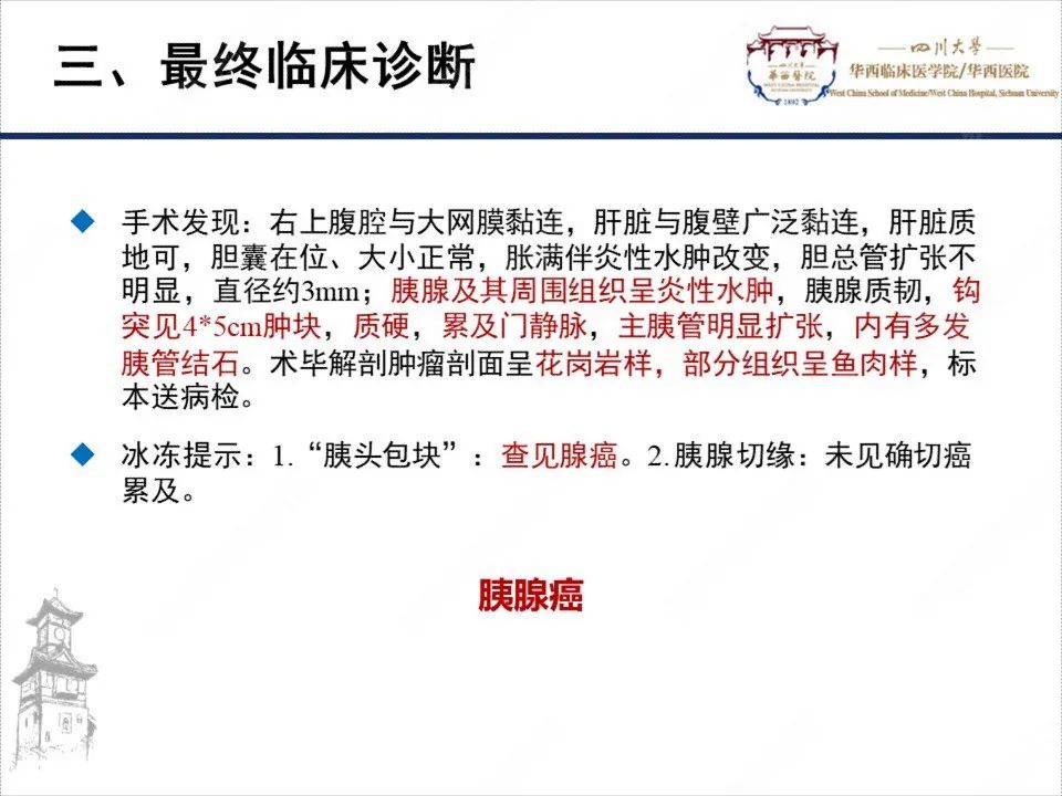 影像PPT - 【病例】胰腺癌1例CT影像-8