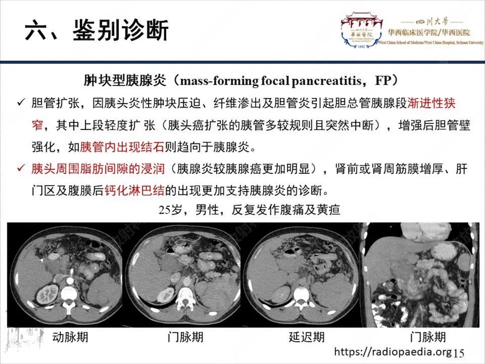 影像PPT - 【病例】胰腺癌1例CT影像-15
