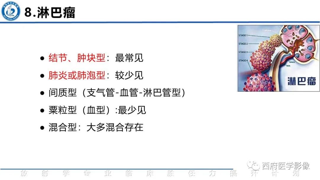 影像PPT - 【PPT】机化性肺炎影像学表现-41