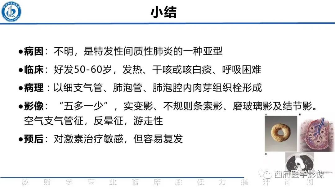 影像PPT - 【PPT】机化性肺炎影像学表现-44