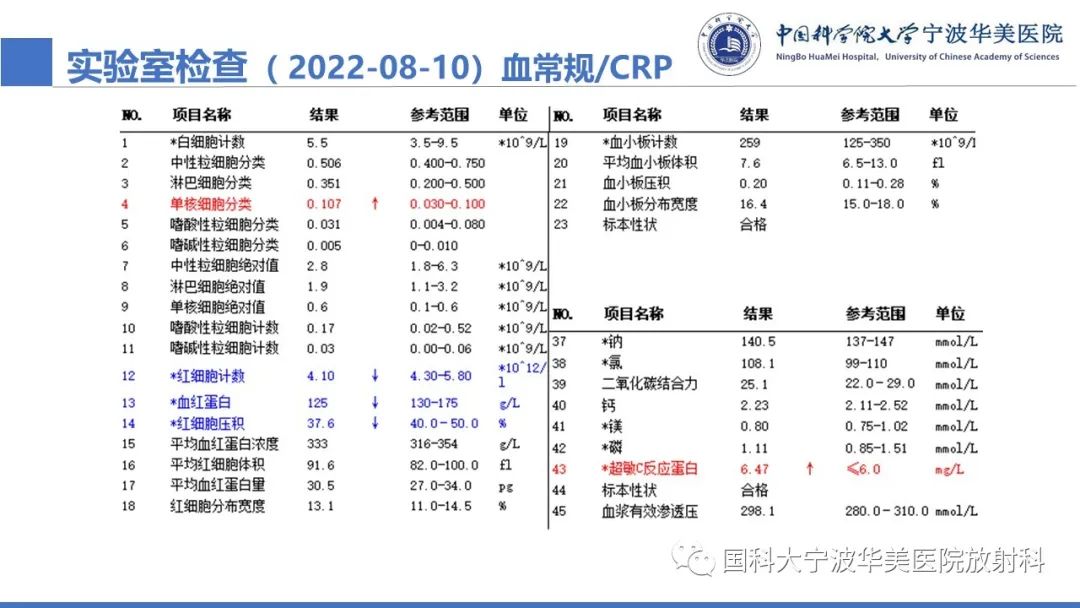 影像PPT - 【PPT】肺粘液腺癌-3