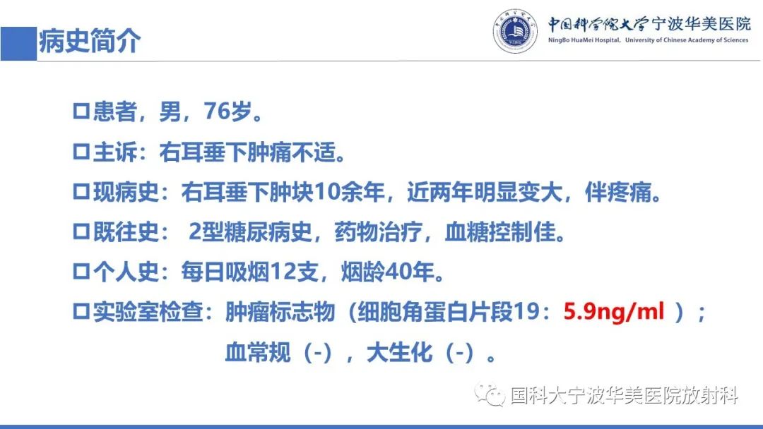 影像PPT - 【PPT】腮腺腺淋巴瘤-2