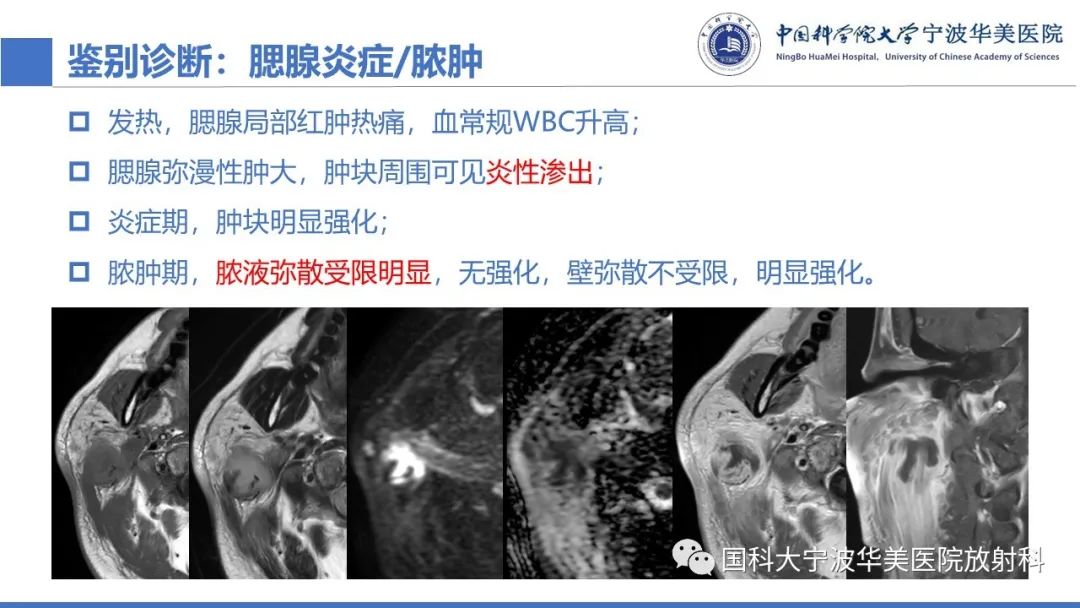 影像PPT - 【PPT】腮腺腺淋巴瘤-22