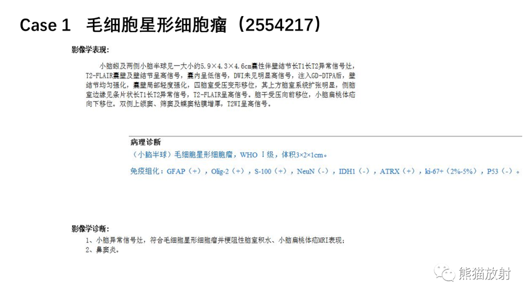 影像PPT - 【病例】小脑毛细胞星形细胞瘤 VS 血管母细胞瘤-12