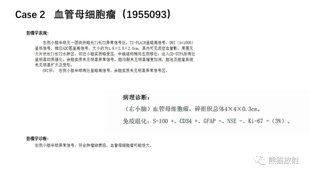 影像PPT - 【病例】小脑毛细胞星形细胞瘤 VS 血管母细胞瘤-13