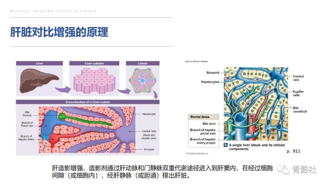 影像PPT - 【PPT】肝环形强化样病变MRI诊断思路-6