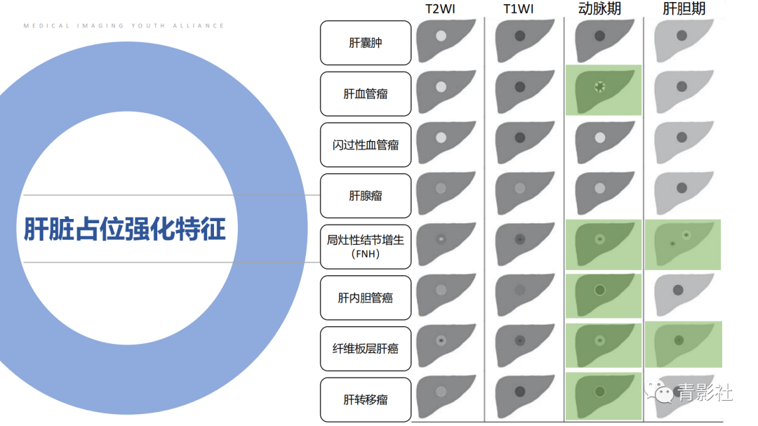 影像PPT - 【PPT】肝环形强化样病变MRI诊断思路-13