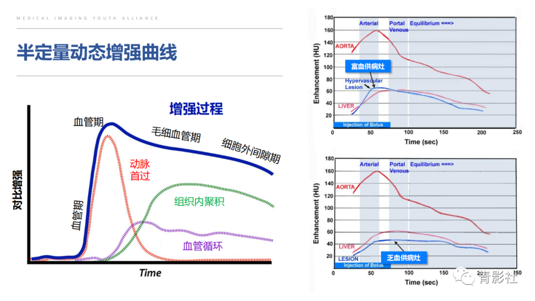 影像PPT - 【PPT】肝环形强化样病变MRI诊断思路-15