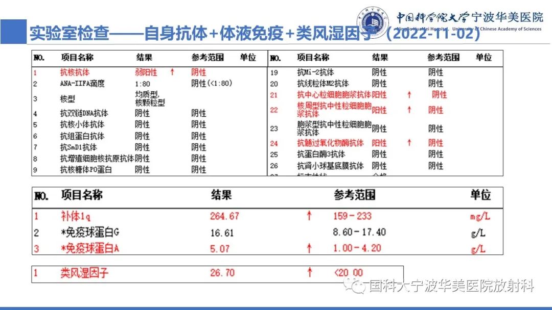 影像PPT - 【病例】抗中性粒细胞胞浆抗体相关性血管炎1例肺部CT表现-5