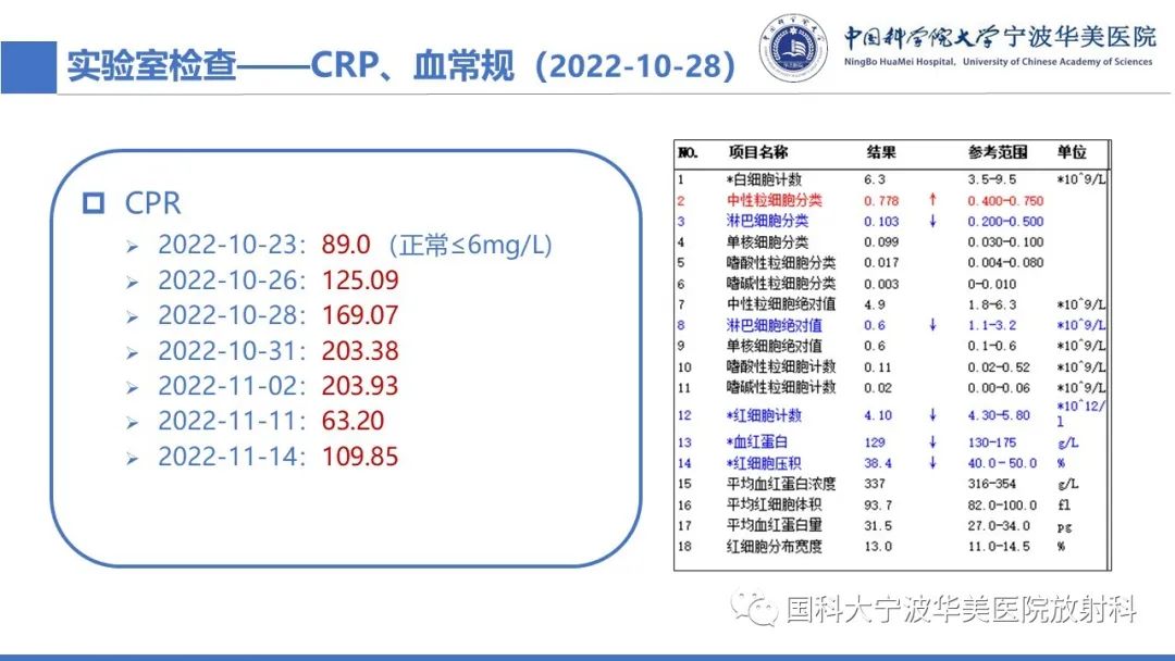 影像PPT - 【病例】抗中性粒细胞胞浆抗体相关性血管炎1例肺部CT表现-3